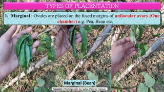 Morphology of Flower (STRUCTURE OF FLOWER). | PDF
