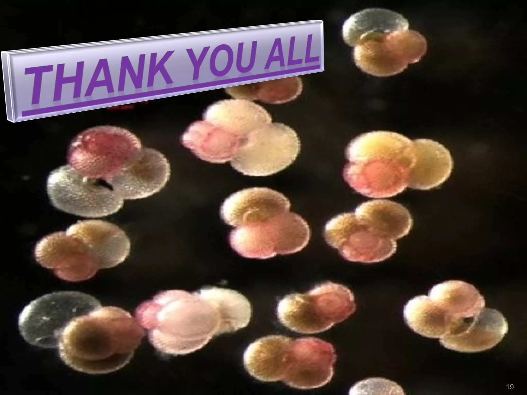 Arrangements of echinus spines, sea star plates, and foraminifera, from the  J.T. Norman microscopy business. Prepared ca. 1880-1900, likely by John T.  Norman's sons William (1840-1917) or Alfred (1861-1936). An illustrated  history, image size:2048x1536