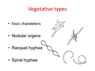 Vegetative types
• Favic chandeliers
• Nodular organs
• Racquet hyphae
• Spiral hyphae
 