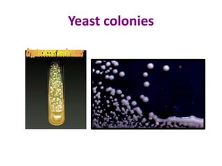 Yeast colonies
Mucoid
colonies
 