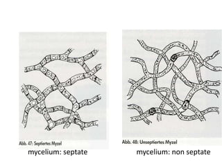 mycelium: septate mycelium: non septate
 