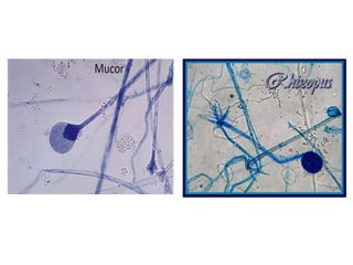 Morphologyoffungi 170226153026