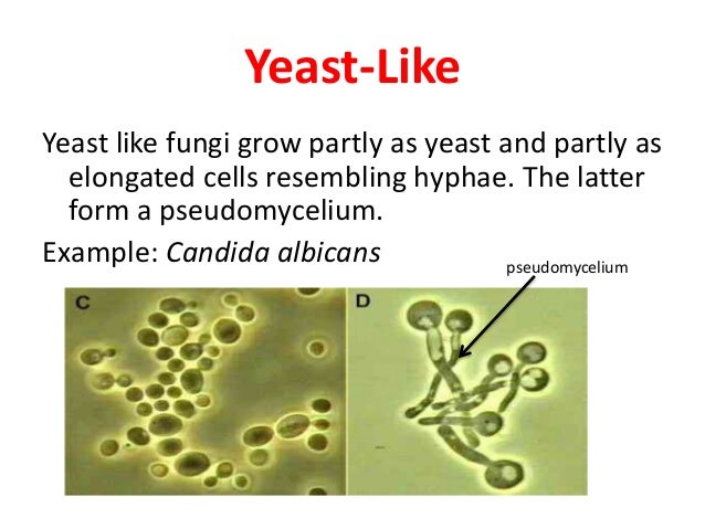 morphology of fungi mycelial form