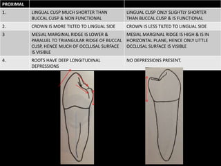 PROXIMAL
1. LINGUAL CUSP MUCH SHORTER THAN
BUCCAL CUSP & NON FUNCTIONAL
LINGUAL CUSP ONLY SLIGHTLY SHORTER
THAN BUCCAL CUSP & IS FUNCTIONAL
2. CROWN IS MORE TILTED TO LINGUAL SIDE CROWN IS LESS TILTED TO LINGUAL SIDE
3 MESIAL MARGINAL RIDGE IS LOWER &
PARALLEL TO TRIANGULAR RIDGE OF BUCCAL
CUSP, HENCE MUCH OF OCCLUSAL SURFACE
IS VISIBLE
MESIAL MARGINAL RIDGE IS HIGH & IS IN
HORIZONTAL PLANE, HENCE ONLY LITTLE
OCCLUSAL SURFACE IS VISIBLE
4. ROOTS HAVE DEEP LONGITUDINAL
DEPRESSIONS
NO DEPRESSIONS PRESENT.
 
