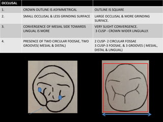 OCCLUSAL
1. CROWN OUTLINE IS ASYMMETRICAL OUTLINE IS SQUARE
2. SMALL OCCLUSAL & LESS GRINDING SURFACE LARGE OCCLUSAL & MORE GRINDING
SURFACE.
3. CONVERGENCE OF MESIAL SIDE TOWARDS
LINGUAL IS MORE
VERY SLIGHT CONVERGENCE.
3 CUSP - CROWN WIDER LINGUALLY.
4. PRESENCE OF TWO CIRCULAR FOOSAE, TWO
GROOVES( MESIAL & DISTAL)
2 CUSP- 2 CIRCULAR FOSSAE
3 CUSP-3 FOOSAE, & 3 GROOVES ( MESIAL,
DISTAL & LINGUAL)
 