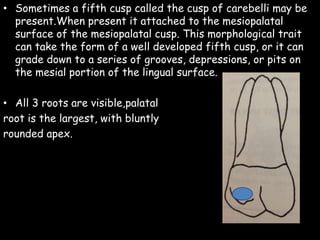 • Sometimes a fifth cusp called the cusp of carebelli may be
present.When present it attached to the mesiopalatal
surface of the mesiopalatal cusp. This morphological trait
can take the form of a well developed fifth cusp, or it can
grade down to a series of grooves, depressions, or pits on
the mesial portion of the lingual surface.
• All 3 roots are visible,palatal
root is the largest, with bluntly
rounded apex.
 