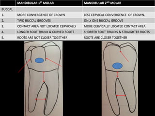 MANDIBULAR 1ST MOLAR MANDIBULAR 2ND MOLAR
BUCCAL
1. MORE CONVERGENCE OF CROWN LESS CERVICAL CONVERGENCE OF CROWN.
2. TWO BUCCAL GROOVES ONLY ONE BUCCAL GROOVE
3. CONTACT AREA NOT LOCATED CERVICALLY MORE CERVICALLY LOCATED CONTACT AREA
4. LONGER ROOT TRUNK & CURVED ROOTS SHORTER ROOT TRUNKS & STRAIGHTER ROOTS
5. ROOTS ARE NOT CLOSER TOGETHER ROOTS ARE CLOSER TOGETHER
 