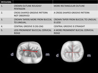 OCCLUSAL
1. CROWN OUTLINE ROUGHLY
PENTAGON
MORE RECTANGULAR OUTLINE
2. CROSS SHAPED GROOVE PATTERN
NOT OBSERVED
A CROSS SHAPED GROOVE PATTERN
3. CROWN TAPERS MORE FROM BUCCAL
TO LINGUAL.
CROWN TAPER FROM BUCCAL TO LINGUAL
IS LESS
4. CENTRAL GROOVE IS ZIG-ZAG CENTRAL GROOVE IS STRAIGHT
5. LESS PROMINENT BUCCCAL CERVICAL
RIDGE
A MORE PROMINENT BUCCAL CERVICAL
RIDGE
 