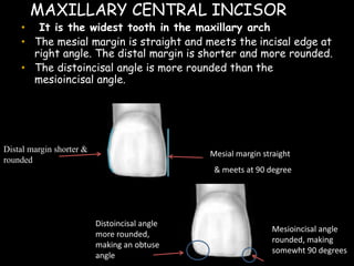 LMAXILLARY CENTRAL INCISORabial
• It is the widest tooth in the maxillary arch.
• The mesial margin is straight and meets the incisal edge at
right angle. The distal margin is shorter and more rounded.
• The distoincisal angle is more rounded than the
mesioincisal angle.
Mesial margin straight
& meets at 90 degree
Distal margin shorter &
rounded
Distoincisal angle
more rounded,
making an obtuse
angle
Mesioincisal angle
rounded, making
somewht 90 degrees
 