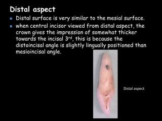 Distal aspect
Distal aspect
 Distal surface is very similar to the mesial surface.
 when central incisor viewed from distal aspect, the
crown gives the impression of somewhat thicker
towards the incisal 3rd, this is because the
distoincisal angle is slightly lingually positioned than
mesioincisal angle.
 