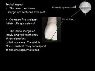 Incisal aspect
• The crown and incisal
margin are centered over root
• Crown profile is almost
bilaterally symmetrical
• The incisal margin of
newly erupted teeth show
three elevations
called mamelons. The middle
One is smallest.They correspond
to the developmental lobes.
Incisal ridge
Bilaterally symmetrical
 