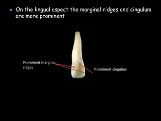  On the lingual aspect the marginal ridges and cingulum
are more prominent
Prominent cingulum
Prominent marginal
ridges
 