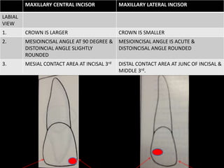 MAXILLARY CENTRAL INCISOR MAXILLARY LATERAL INCISOR
LABIAL
VIEW
1. CROWN IS LARGER CROWN IS SMALLER
2. MESIOINCISAL ANGLE AT 90 DEGREE &
DISTOINCIAL ANGLE SLIGHTLY
ROUNDED
MESIOINCISAL ANGLE IS ACUTE &
DISTOINCISAL ANGLE ROUNDED
3. MESIAL CONTACT AREA AT INCISAL 3rd DISTAL CONTACT AREA AT JUNC OF INCISAL &
MIDDLE 3rd.
 
