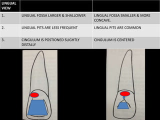 LINGUAL
VIEW
1. LINGUAL FOSSA LARGER & SHALLOWER LINGUAL FOSSA SMALLER & MORE
CONCAVE.
2. LINGUAL PITS ARE LESS FREQUENT LINGUAL PITS ARE COMMON
3. CINGULUM IS POSTIONED SLIGHTLY
DISTALLY
CINGULUM IS CENTERED
 