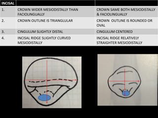 INCISAL
1. CROWN WIDER MESIODISTALLY THAN
FACIOLINGUALLY
CROWN SAME BOTH MESIODISTALLY
& FACIOLINGUALLY
2. CROWN OUTLINE IS TRIANGLULAR CROWN OUTLINE IS ROUNDED OR
OVAL
3. CINGULUM SLIGHTLY DISTAL CINGULUM CENTERED
4. INCISAL RIDGE SLIGHTLY CURVED
MESIODISTALLY
INCISAL RIDGE RELATIVELY
STRAIGHTER MESIODISTALLY
 