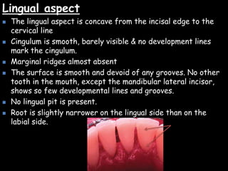 Lingual aspect
 The lingual aspect is concave from the incisal edge to the
cervical line
 Cingulum is smooth, barely visible & no development lines
mark the cingulum.
 Marginal ridges almost absent
 The surface is smooth and devoid of any grooves. No other
tooth in the mouth, except the mandibular lateral incisor,
shows so few developmental lines and grooves.
 No lingual pit is present.
 Root is slightly narrower on the lingual side than on the
labial side.
 