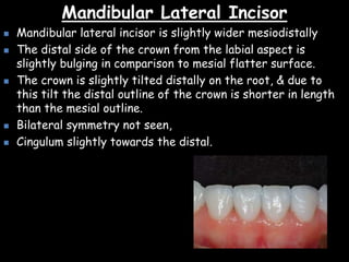 Mandibular Lateral Incisor
 Mandibular lateral incisor is slightly wider mesiodistally
 The distal side of the crown from the labial aspect is
slightly bulging in comparison to mesial flatter surface.
 The crown is slightly tilted distally on the root, & due to
this tilt the distal outline of the crown is shorter in length
than the mesial outline.
 Bilateral symmetry not seen,
 Cingulum slightly towards the distal.
 