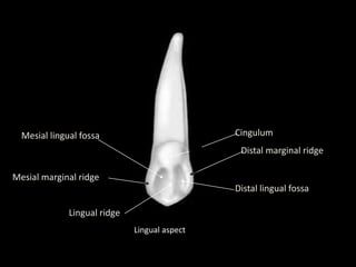 Lingual aspect
Cingulum
Distal marginal ridge
Distal lingual fossa
Lingual ridge
Mesial marginal ridge
Mesial lingual fossa
 