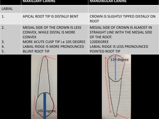 MAXILLARY CANINE MANDIBULAR CANINE
LABIAL
1. APICAL ROOT TIP IS DISTALLY BENT CROWN IS SLIGHTLY TIPPED DISTALLY ON
ROOT
2.
3.
4.
5.
MESIAL SIDE OF THE CROWN IS LESS
CONVEX, WHILE DISTAL IS MORE
CONVEX
MORE ACUTE CUSP TIP i.e 105 DEGREE
LABIAL RIDGE IS MORE PRONOUNCED
BLUNT ROOT TIP
MESIAL SIDE OF CROWN IS ALMOST IN
STRAIGHT LINE WITH THE MESIAL SIDE
OF THE ROOT.
120DEGREE
LABIAL RIDGE IS LESS PRONOUNCED
POINTED ROOT TIP
120 degree
105 degree
 