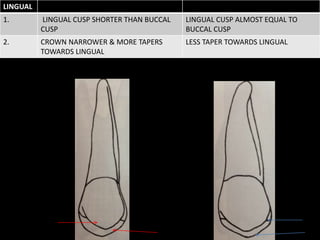 LINGUAL
1. LINGUAL CUSP SHORTER THAN BUCCAL
CUSP
LINGUAL CUSP ALMOST EQUAL TO
BUCCAL CUSP
2. CROWN NARROWER & MORE TAPERS
TOWARDS LINGUAL
LESS TAPER TOWARDS LINGUAL
 