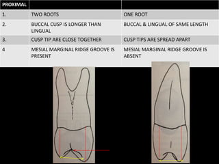 PROXIMAL
1. TWO ROOTS ONE ROOT
2. BUCCAL CUSP IS LONGER THAN
LINGUAL
BUCCAL & LINGUAL OF SAME LENGTH
3. CUSP TIP ARE CLOSE TOGETHER CUSP TIPS ARE SPREAD APART
4 MESIAL MARGINAL RIDGE GROOVE IS
PRESENT
MESIAL MARGINAL RIDGE GROOVE IS
ABSENT
 