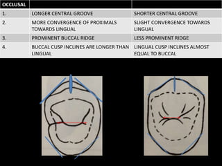 OCCLUSAL
1. LONGER CENTRAL GROOVE SHORTER CENTRAL GROOVE
2. MORE CONVERGENCE OF PROXIMALS
TOWARDS LINGUAL
SLIGHT CONVERGENCE TOWARDS
LINGUAL
3. PROMINENT BUCCAL RIDGE LESS PROMINENT RIDGE
4. BUCCAL CUSP INCLINES ARE LONGER THAN
LINGUAL
LINGUAL CUSP INCLINES ALMOST
EQUAL TO BUCCAL
 