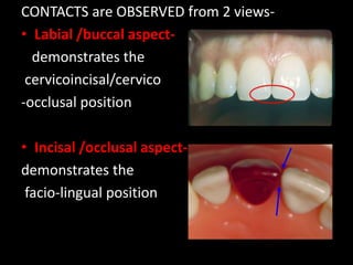 CONTACTS are OBSERVED from 2 views-
• Labial /buccal aspect-
demonstrates the
cervicoincisal/cervico
-occlusal position
• Incisal /occlusal aspect-
demonstrates the
facio-lingual position
 