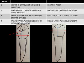 LINGUAL
1. CROWN IS NARROWER THAN SECOND
PREMOLAR
CROWN IS WIDER
2. LINGUAL CUSP IS SHORT & NARROW &
NONFUNCTIIONAL
LINGUAL CUSP LARGER & FUNCTIONAL
3. FROM THIS ASPECT MORE OF OCCLUSAL
SURFACE IS VISIBLE
VERY LESS OCCLUSAL SURFACE IS VISIBLE
4 MESIAL MARGINAL RIDGE IS DIVIDED BY
MESIOLINGUAL GROOVE
MESIAL MARGINAL GROOVE IS ABSENT
 