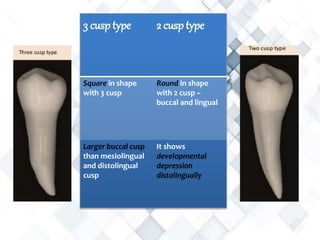 3 cusp type 2 cusp type
Square in shape
with 3 cusp
Round in shape
with 2 cusp –
buccal and lingual
Larger buccal cusp
than mesiolingual
and distolingual
cusp
It shows
developmental
depression
distolingually
 