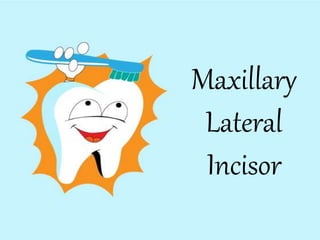 Maxillary
Lateral
Incisor
 