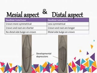 Mesial aspect
Mandibular Central Incisor Mandibular Lateral Incisor
Crown more symmetrical Less symmetrical
Crown and root are shorter Crown and root are longer
No distal side bulge on crown Distal side bulge on crown
Distal aspect
Developmental
depressions
 