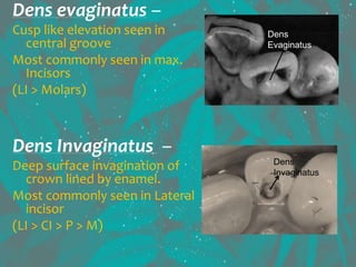 Dens evaginatus –
Cusp like elevation seen in
central groove
Most commonly seen in max.
Incisors
(LI > Molars)
Dens Invaginatus –
Deep surface invagination of
crown lined by enamel.
Most commonly seen in Lateral
incisor
(LI > CI > P > M)
Dens
Invaginatus
Dens
Evaginatus
 