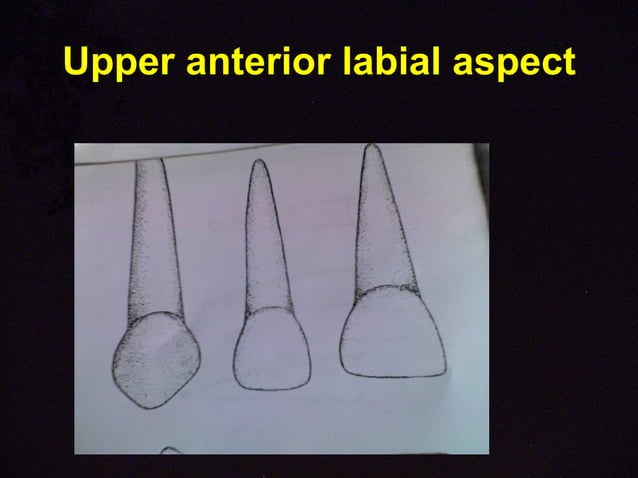 Morphology of primary teeth pedodontics | PPT