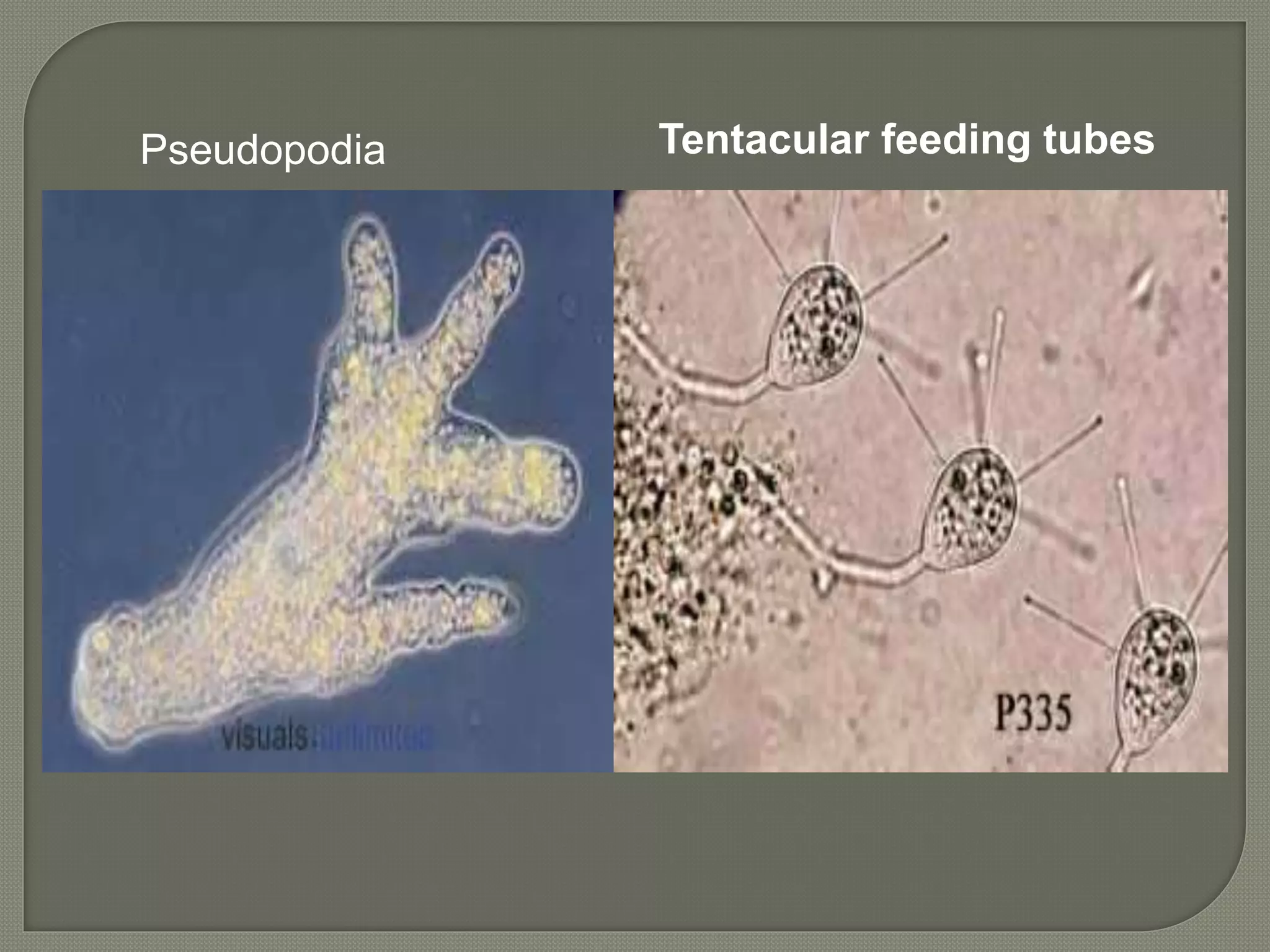 Pseudopodia Tentacular feeding tubes
 