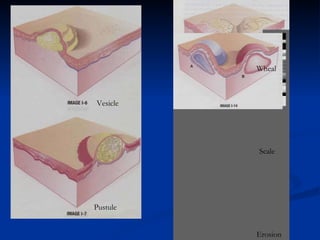 Morphology of skin lesions | PPT