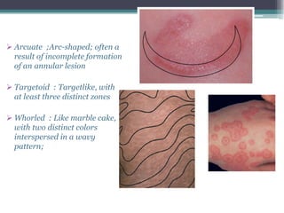 Morphology of skin lesions tim | PDF