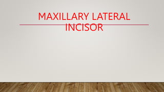 MAXILLARY LATERAL
INCISOR
 