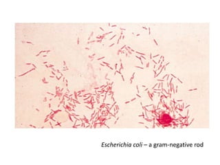 Escherichia coli – a gram-negative rod
 