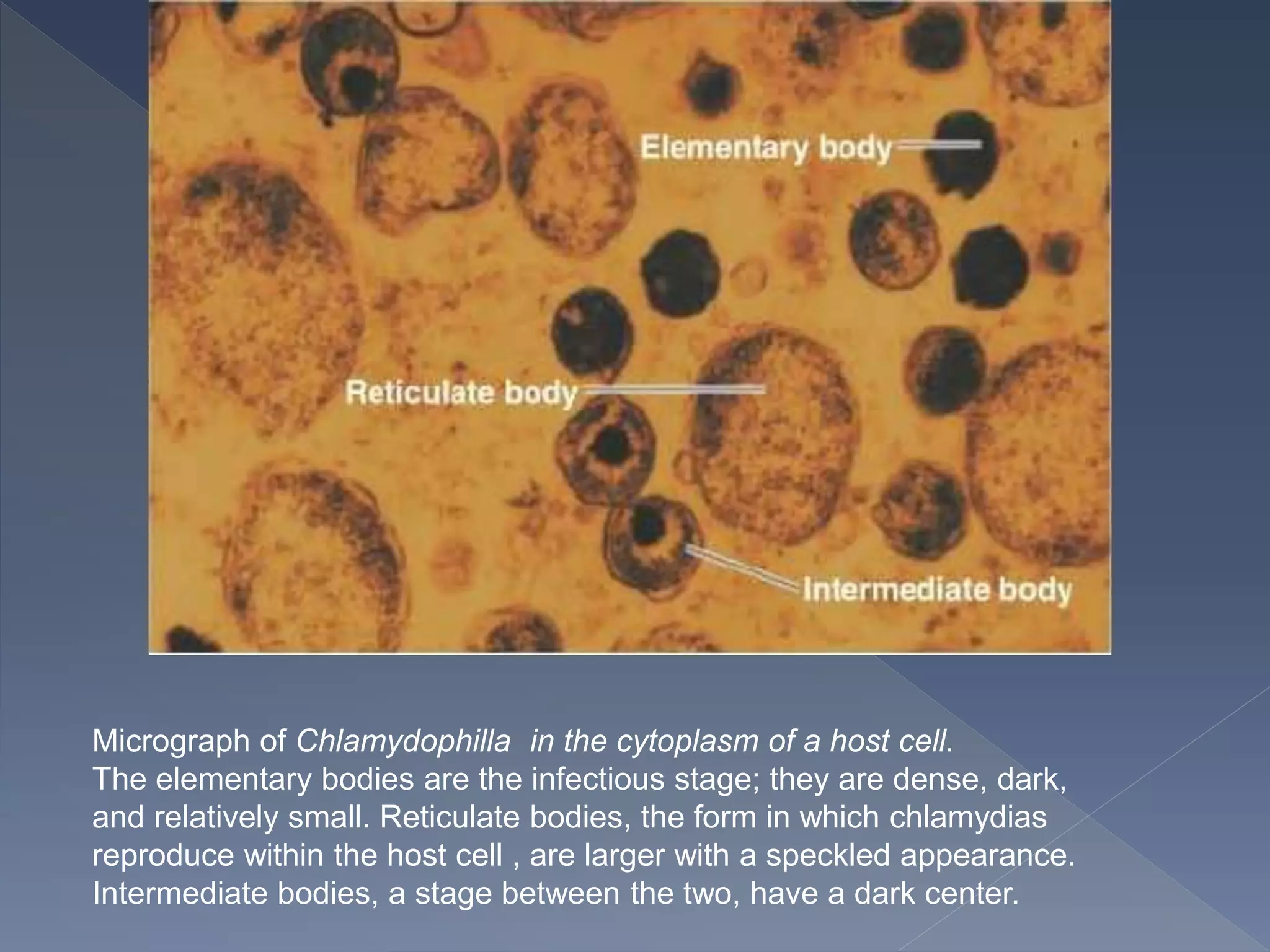 Micrograph of Chlamydophilla in the cytoplasm of a host cell.
The elementary bodies are the infectious stage; they are dense, dark,
and relatively small. Reticulate bodies, the form in which chlamydias
reproduce within the host cell , are larger with a speckled appearance.
Intermediate bodies, a stage between the two, have a dark center.
 