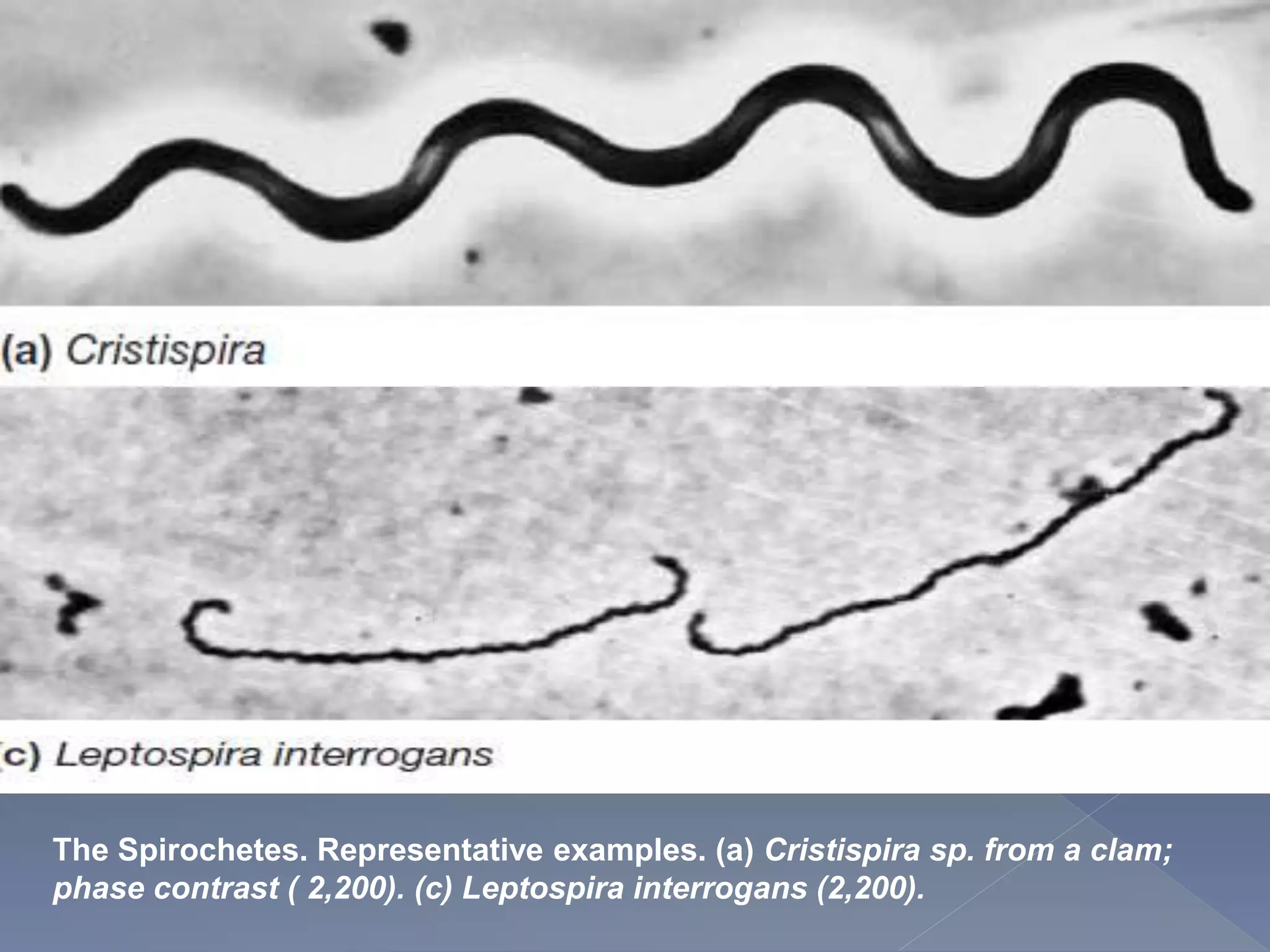 The Spirochetes. Representative examples. (a) Cristispira sp. from a clam;
phase contrast ( 2,200). (c) Leptospira interrogans (2,200).
 
