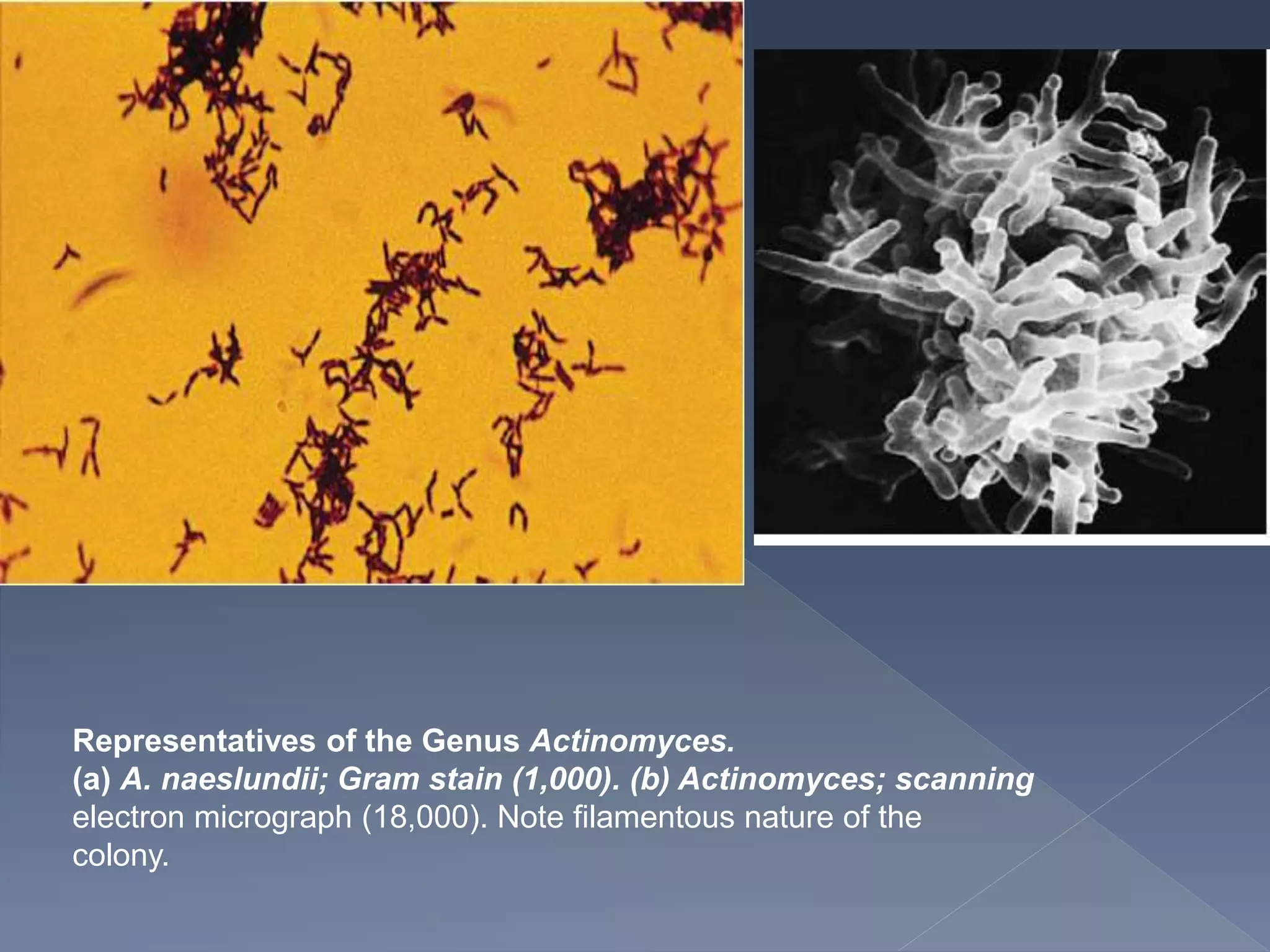 Representatives of the Genus Actinomyces.
(a) A. naeslundii; Gram stain (1,000). (b) Actinomyces; scanning
electron micrograph (18,000). Note filamentous nature of the
colony.
 