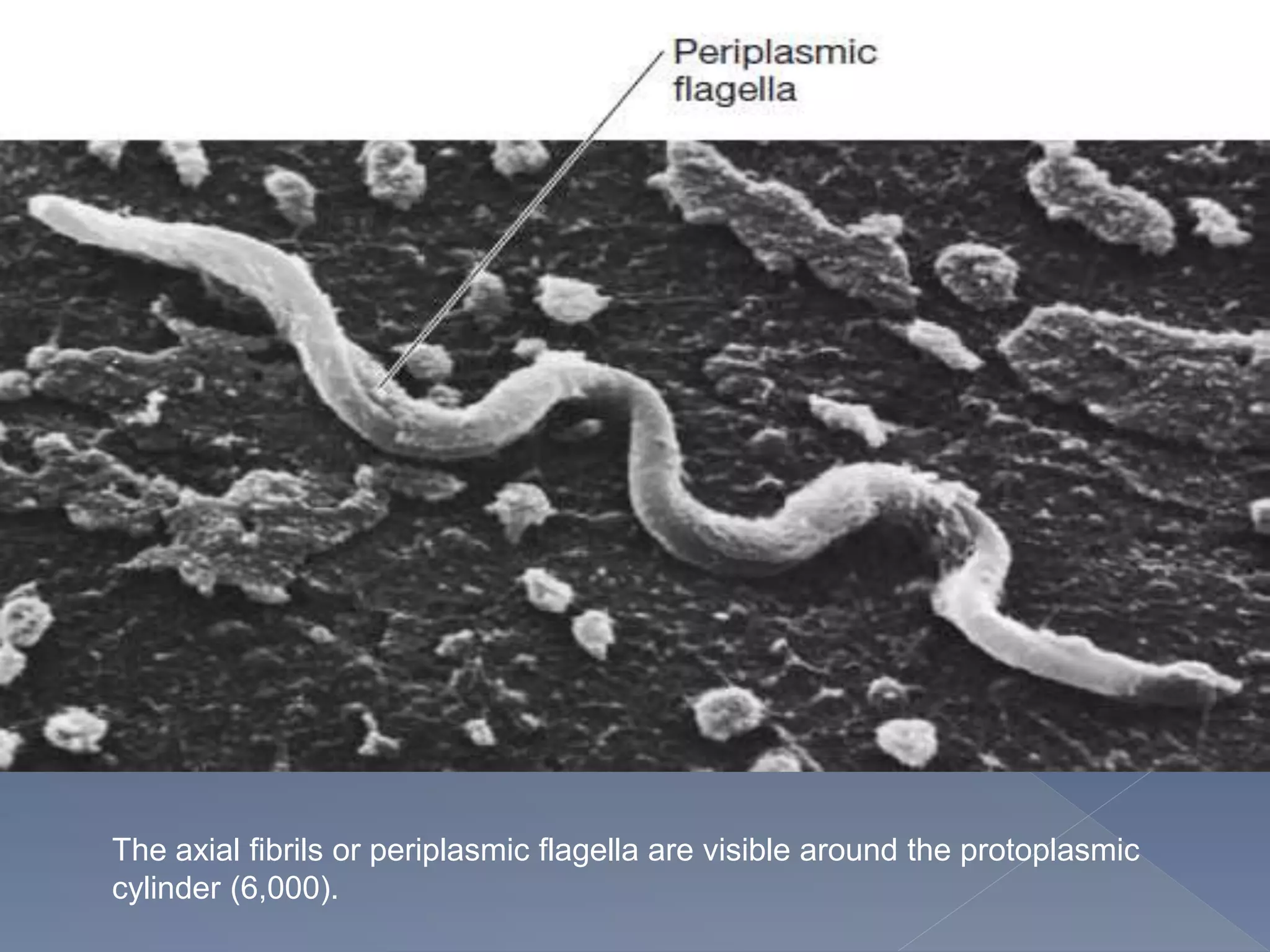 The axial fibrils or periplasmic flagella are visible around the protoplasmic
cylinder (6,000).
 