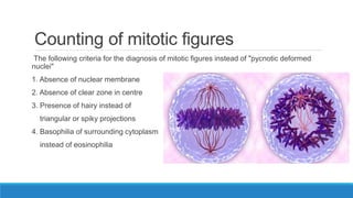 Counting of mitotic figures
The following criteria for the diagnosis of mitotic figures instead of "pycnotic deformed
nuclei"
1. Absence of nuclear membrane
2. Absence of clear zone in centre
3. Presence of hairy instead of
triangular or spiky projections
4. Basophilia of surrounding cytoplasm
instead of eosinophilia
 