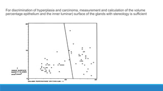 For discrimination of hyperplasia and carcinoma, measurement and calculation of the volume
percentage epithelium and the inner luminar) surface of the glands with stereology is sufficient
 