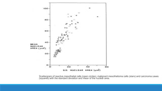 Scattergram of reactive mesothelial cells (open circles), malignant mesothelioma cells (stars) and carcinoma cases
(squares) with the standard deviation and mean of the nuclear area.
 