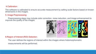 4.Calibration:
The software is calibrated to ensure accurate measurement by setting scale factors based on known
dimensions in the images.
5. Image Preprocessing:
Preprocessing steps may include color correction, noise reduction, and image enhancement to
improve the quality of the images.
6.Region of Interest (ROI) Selection:
The user defines the regions of interest within the images where histomorphometric
measurements will be performed.
 