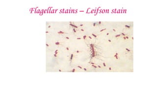 Flagellar stains – Leifson stain
 