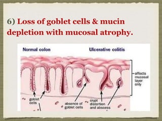 6) Loss of goblet cells & mucin
depletion with mucosal atrophy.
 