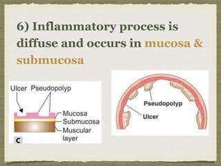 6) Inflammatory process is
diffuse and occurs in mucosa &
submucosa
 