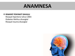 ANAMNESA
 RIWAYAT PENYAKIT DAHULU
Riwayat hipertensi tahun 2003
Diabetes Melitus disangkal
Riwayat trauma disangkal
 